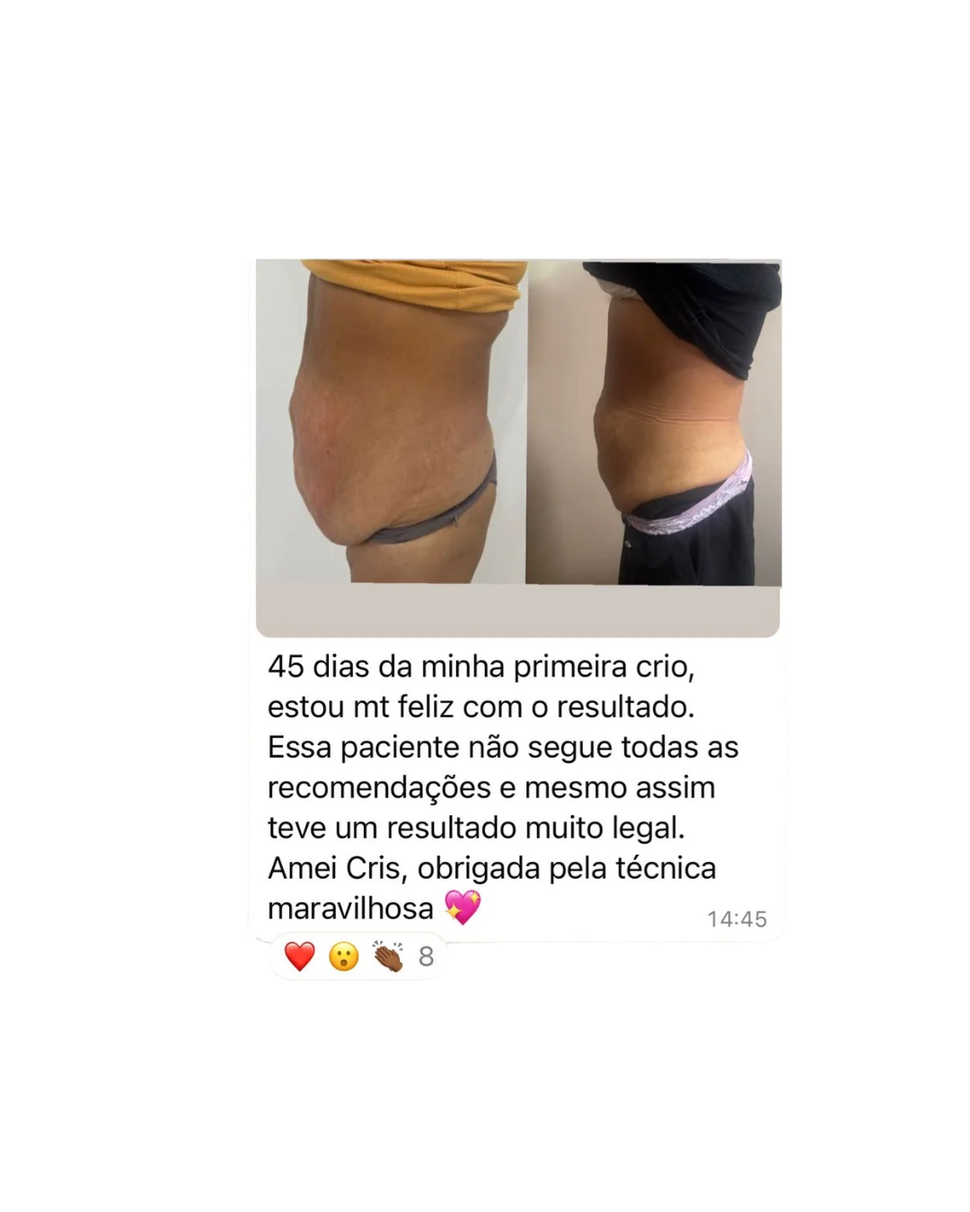 Depoimento WhatsApp — 45 dias de resultado