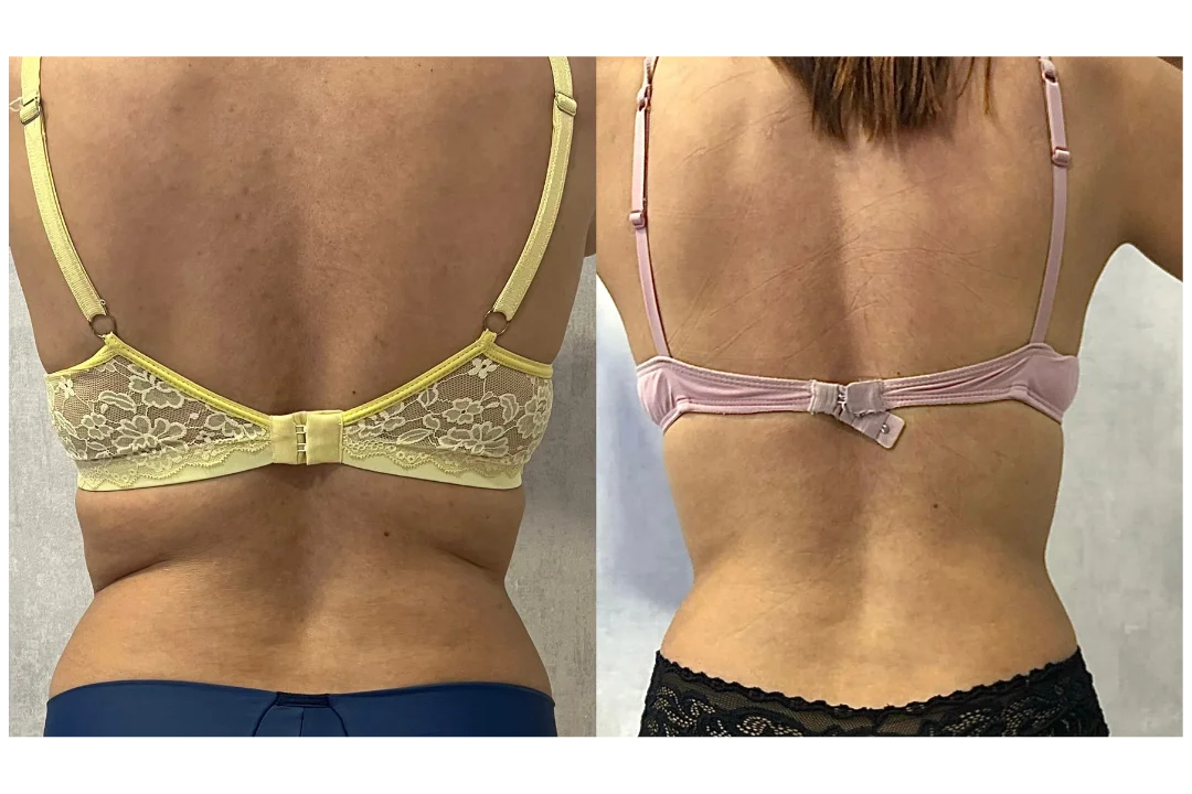 Antes e depois Crio Sessão Única — aluna 3